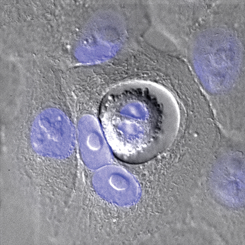 Figure 3: Entosis in live MCF10A cells. Cells were visualised using DIC, with nuclei stained using Hoechst (blue). The outer cell is binucleate (see text for information on host cell division failure) and the inner cell is dividing (proving it is live and viable). 