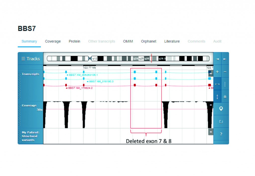 Visual representation of DNA sequencing data using Sapientia allows clinicians to see exon 7 and 8 are not present in the patient, when compared to a health sequence.