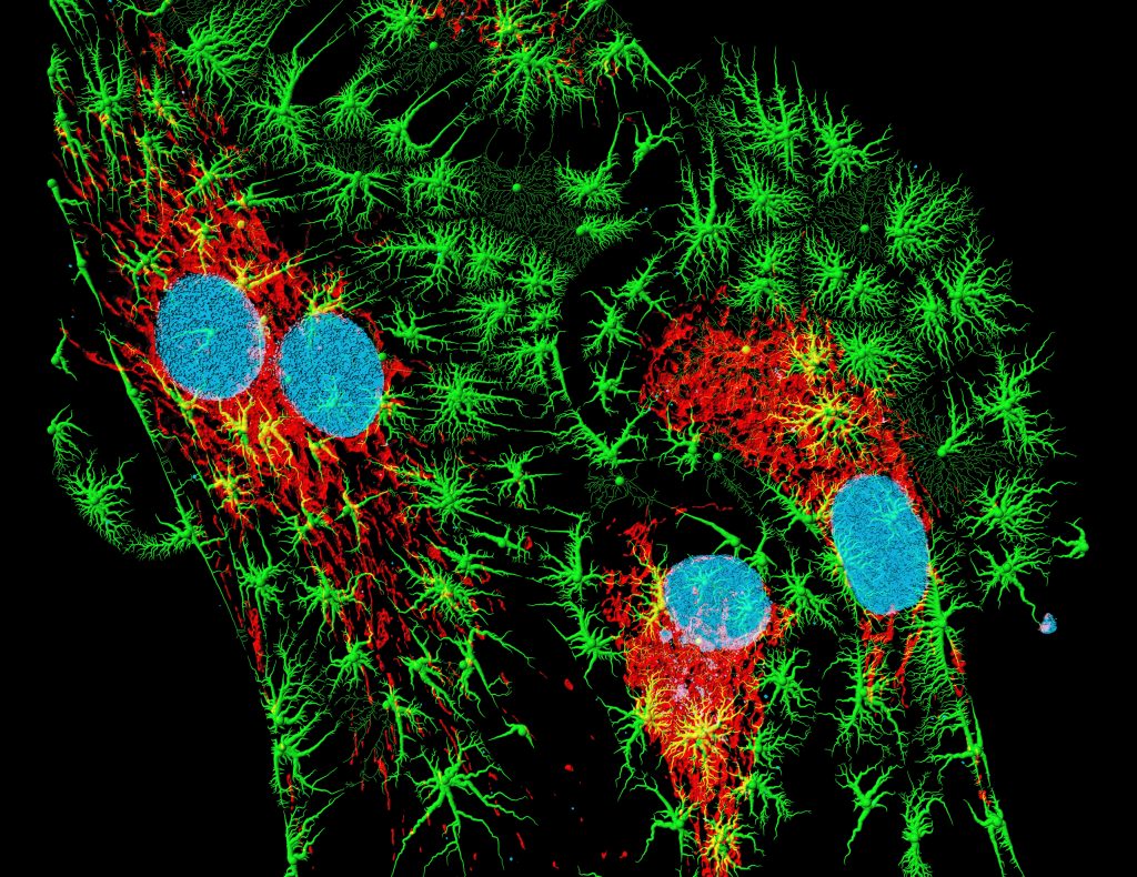 A new form of fluorescence microscopy is currently turning scientists' heads - 