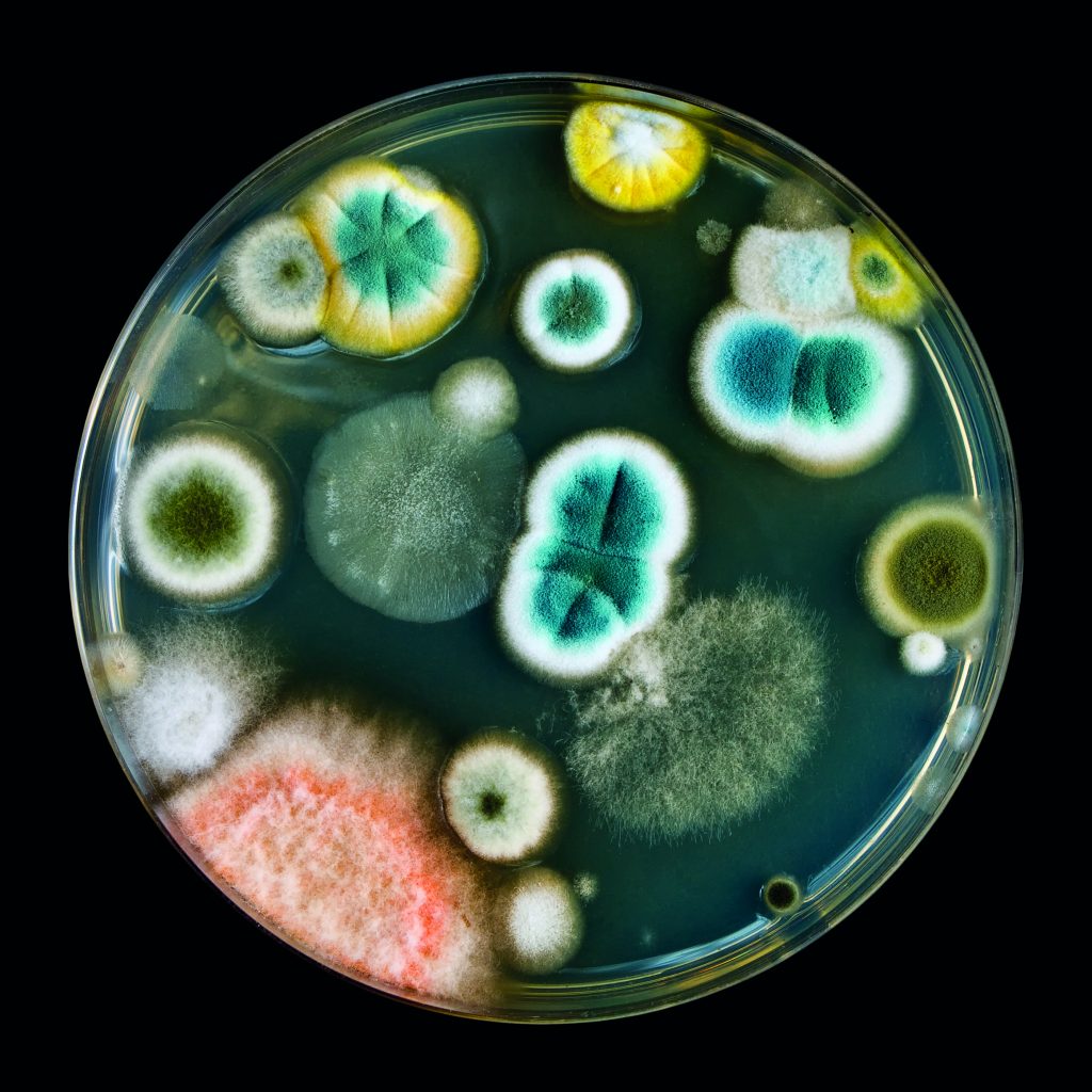 It is much harder to detect mycoplasma contamination compared to other bacterial or fungal contaminations.